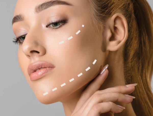 Preenchimento com Ácido Hialurônico - (Linha Restylane®)